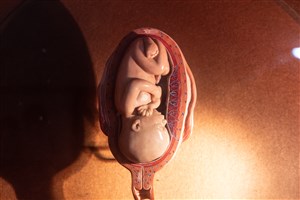 Image description is not available for 1983.72.1